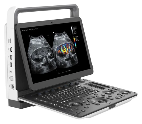 Ultrasò Doppler color portàtil